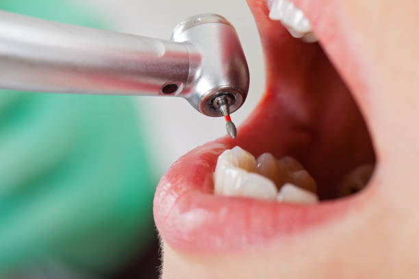 Professional Emergency Dental Service in CT